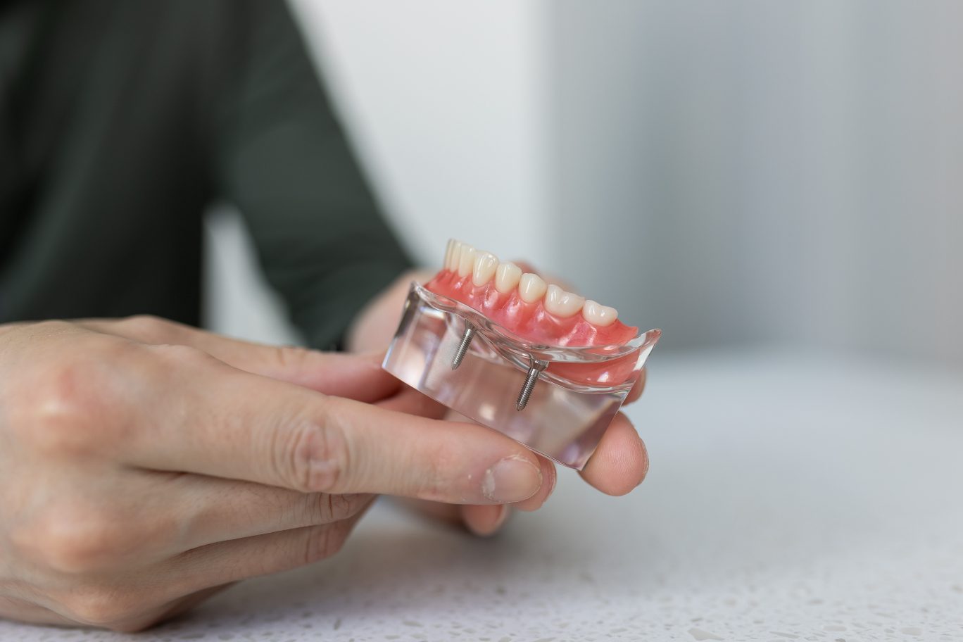 Dental Crowns