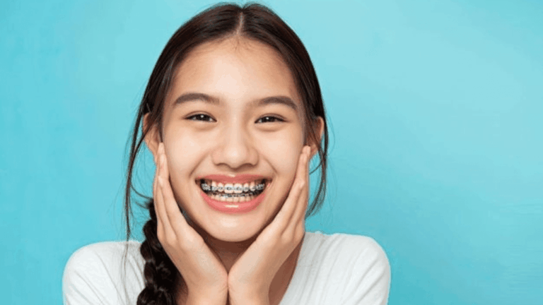 Braces Cost