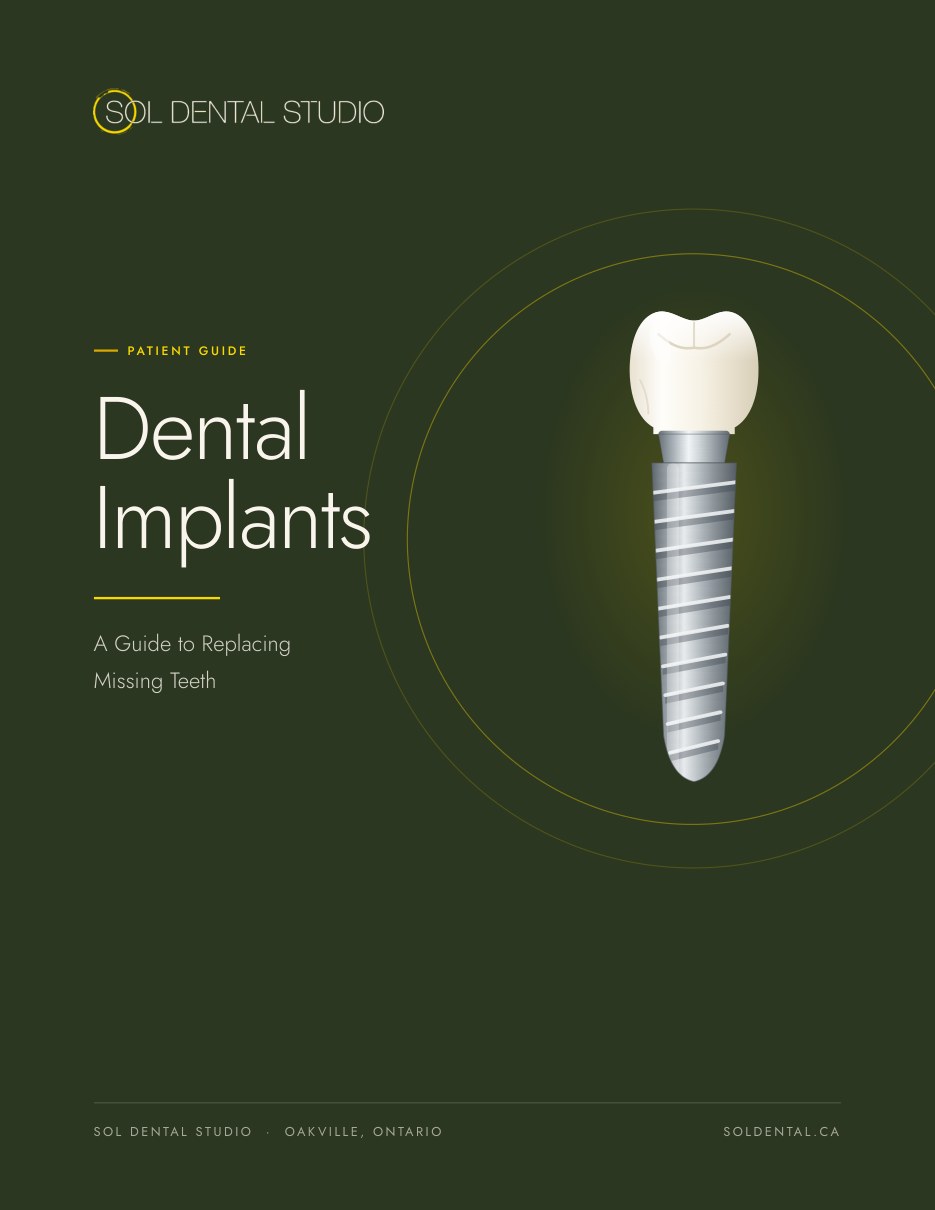 Dental Implants — free patient guide