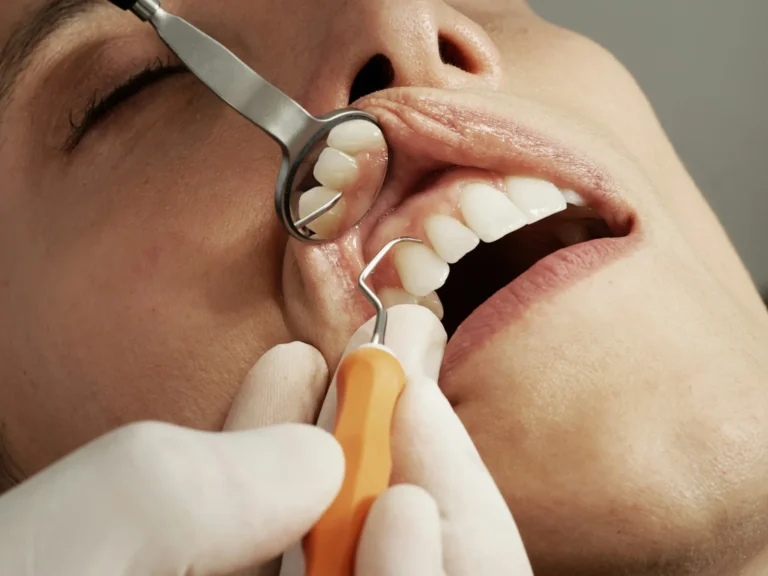 Dental mirror and probe checking the gums during a dental exam